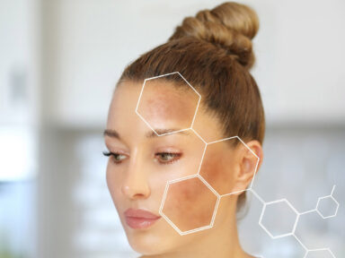 Pigmentation Treatment Dubai