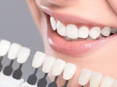 Nano Teeth Whitening