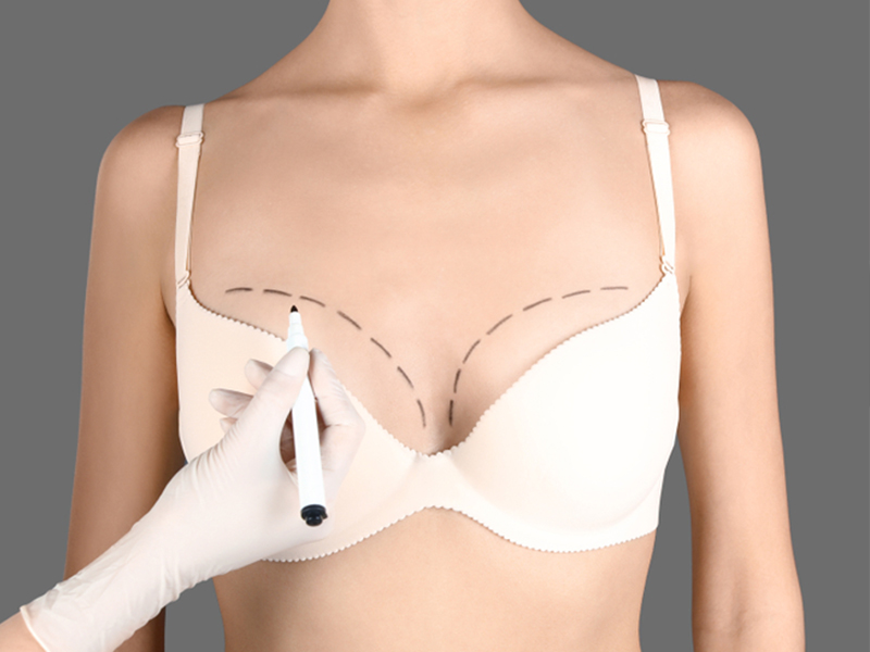 Breast Reduction Dubai