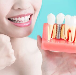 Digital dental implant