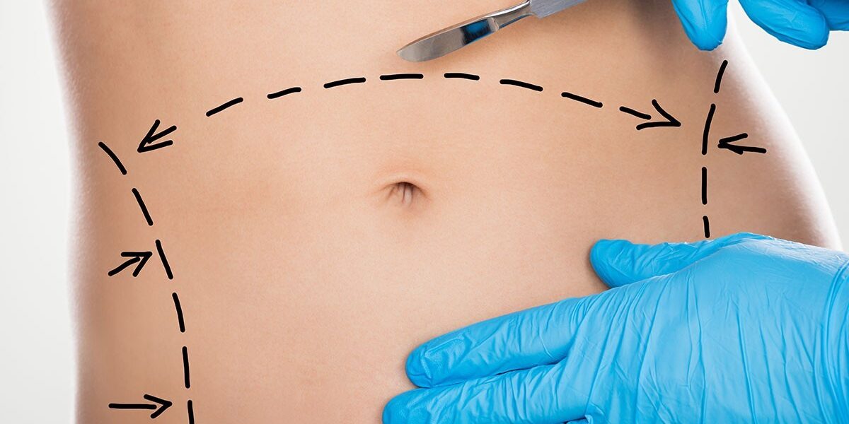 Dubai Mommy Makeover