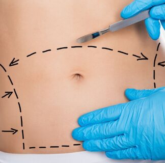 Dubai Mommy Makeover