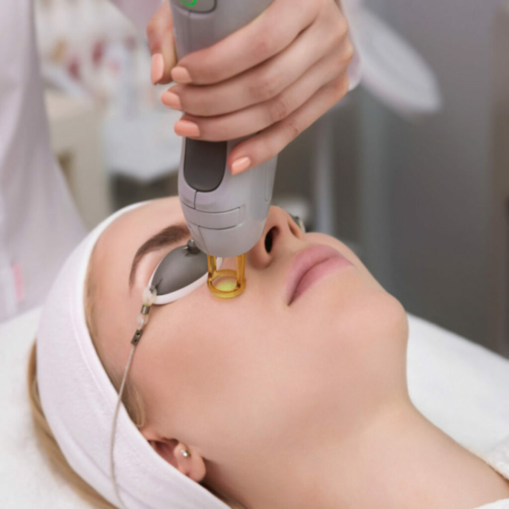 Laser Skin Resurfacing