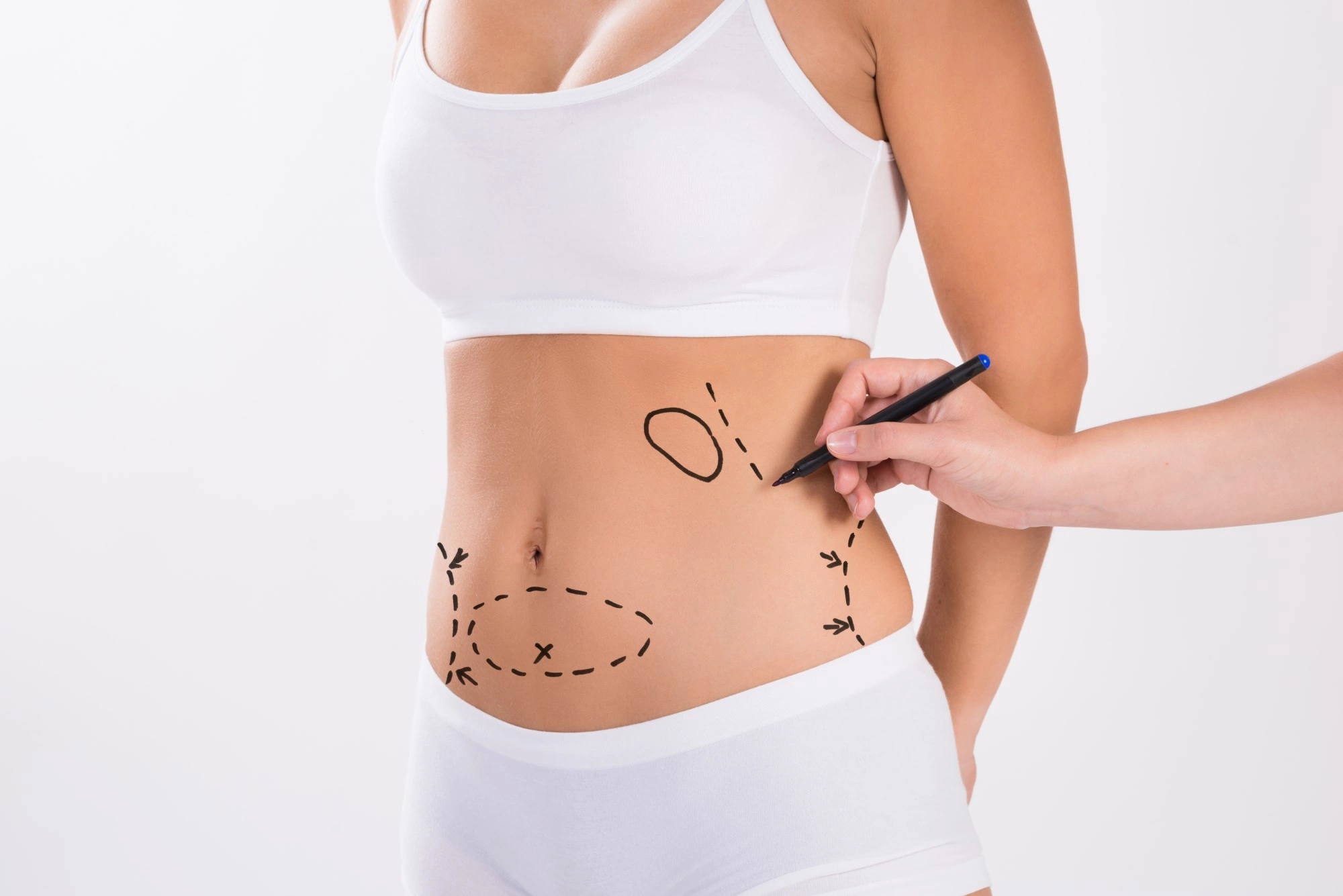 Liposuction Fat Transfer