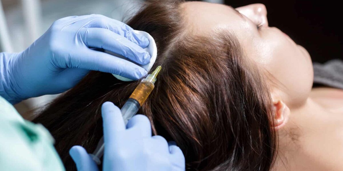 PRP Hair Treatment Dubai