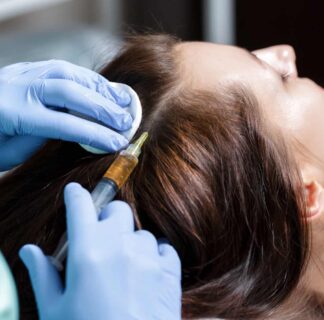 PRP Hair Treatment Dubai