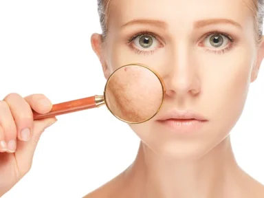 Pigmentation Treatment