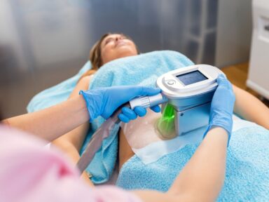 coolsculpting treatment image