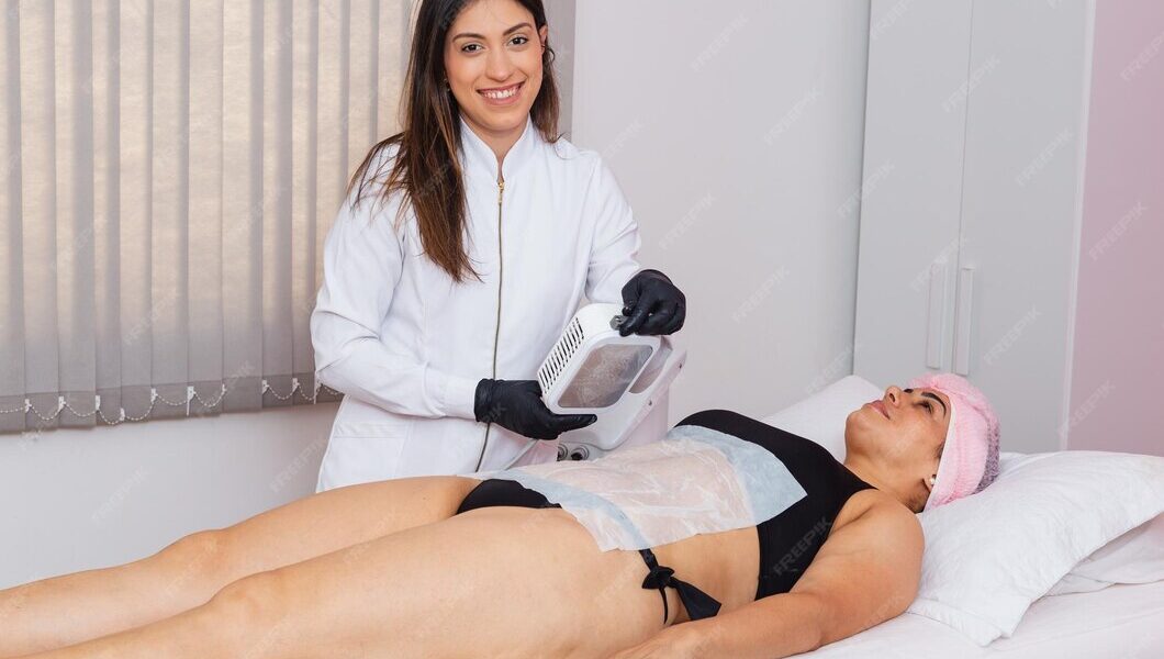 Cryolipolysis