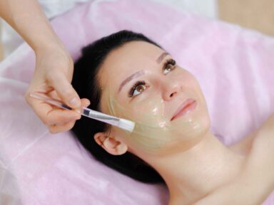 Chemical Peel Treatment