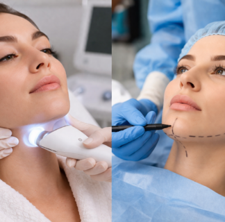 Double Chin Reduction