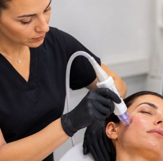 Secret RF Microneedling