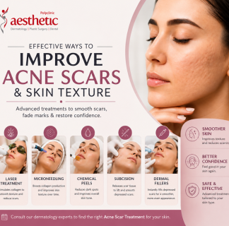 acne scar