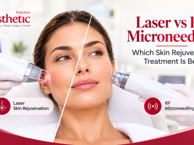 Laser vs RF Microneedling
